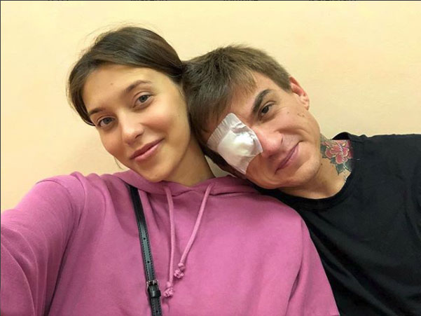 Влад Топалов получил травму глаза